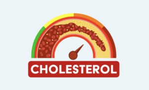 High cholesterol guidelines